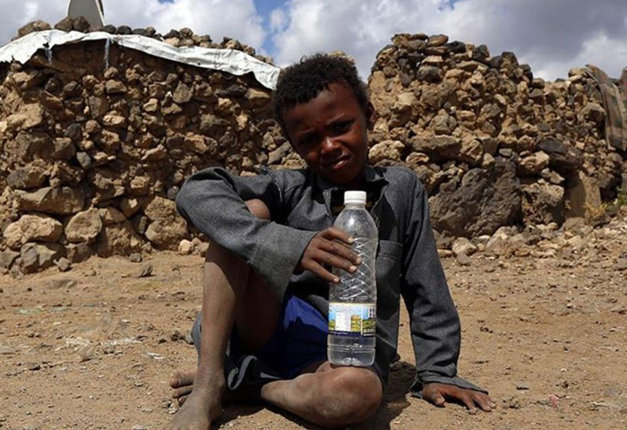 Yemen'de insani kriz: Milyonlarca çocuk tehlikede